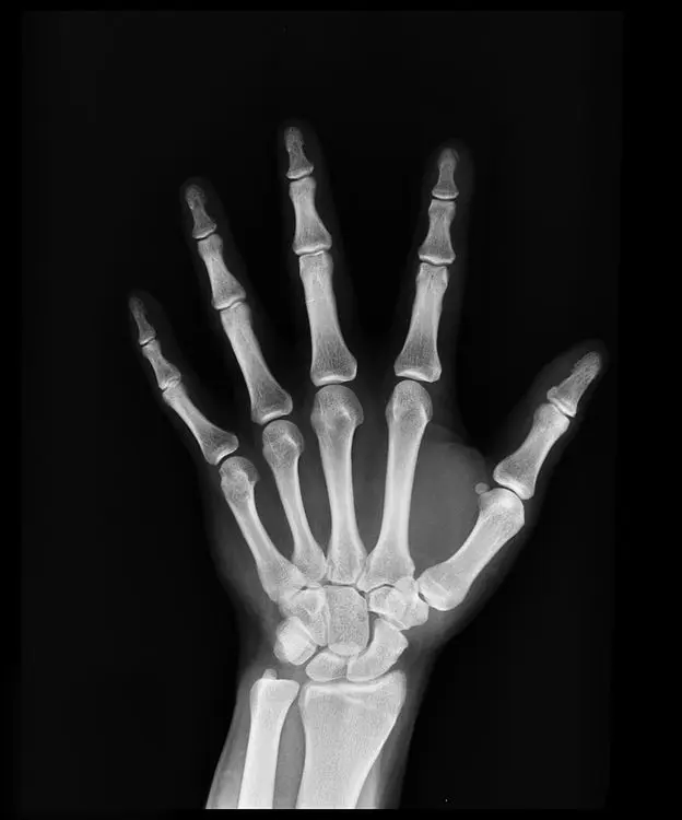 Radiografía de mano disponible en el portal